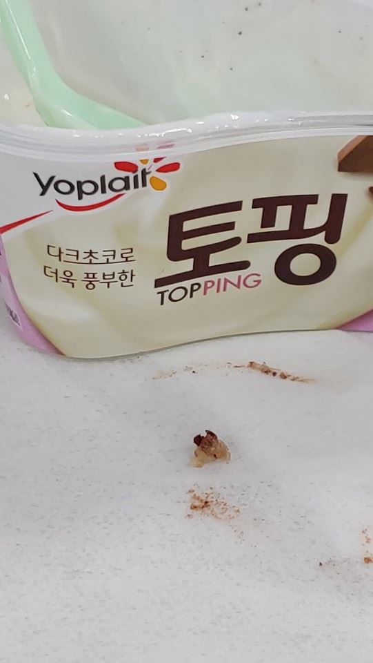 빙그레 요플레를 먹다가 치아가 파절됐다는 소비자 A씨 (사진=온라인커뮤니티 캡처)